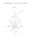 HIP JOINT DEVICE AND METHOD diagram and image