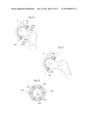 HIP JOINT DEVICE AND METHOD diagram and image