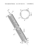 STENT AND METHOD FOR MANUFACTURING THEREOF diagram and image