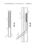 APPARATUS, SYSTEMS AND METHODS FOR MEDICAL DEVICE EXPANSION diagram and image