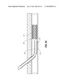 APPARATUS, SYSTEMS AND METHODS FOR MEDICAL DEVICE EXPANSION diagram and image