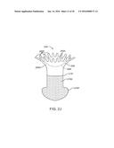 NASOLACRIMAL DRAINAGE SYSTEM IMPLANTS FOR DRUG THERAPY diagram and image