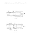 NASOLACRIMAL DRAINAGE SYSTEM IMPLANTS FOR DRUG THERAPY diagram and image