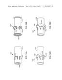 NASOLACRIMAL DRAINAGE SYSTEM IMPLANTS FOR DRUG THERAPY diagram and image