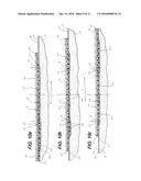 Apparatus and System for Turning and Positioning a Patient/US diagram and image