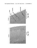 COMPOUNDS AND METHODS FOR TREATING ABERRANT ADRENOCORTICAL CELL DISORDERS diagram and image