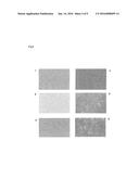 IMMUNOGENIC POLYPEPTIDE SURFACE LAYER-EXPRESSING BIFIDOBACTERIUM diagram and image