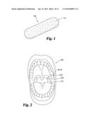 TONSILLECTOMY SPONGE diagram and image