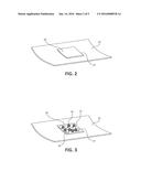 PHARMACEUTICAL COMPOSITIONS AND DEVICES FOR TREATMENT OF PROLIFERATIVE     DISEASES diagram and image