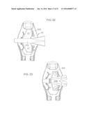 Universal Catheter Securement Device diagram and image