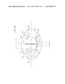 Universal Catheter Securement Device diagram and image