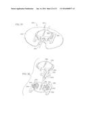 Universal Catheter Securement Device diagram and image