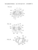 Universal Catheter Securement Device diagram and image