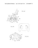 Universal Catheter Securement Device diagram and image