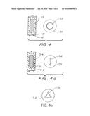 IMPLANT MAGNET SYSTEM diagram and image