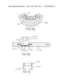 IMPLANT MAGNET SYSTEM diagram and image