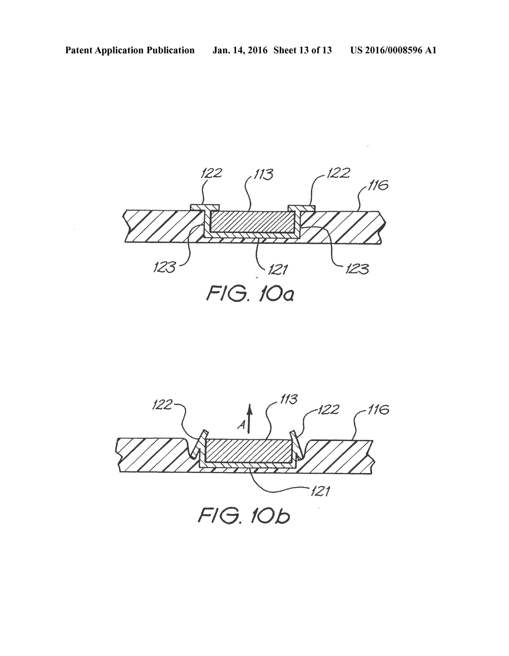 IMPLANT MAGNET SYSTEM - diagram, schematic, and image 14