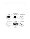 SINGLE CHANNEL COCHLEAR IMPLANT ARTIFACT ATTENUATION IN LATE AUDITORY     EVOKED POTENTIALS diagram and image