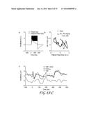 SINGLE CHANNEL COCHLEAR IMPLANT ARTIFACT ATTENUATION IN LATE AUDITORY     EVOKED POTENTIALS diagram and image