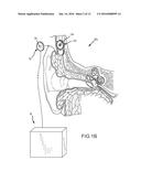 RELAY INTERFACE FOR CONNECTING AN IMPLANTED MEDICAL DEVICE TO AN EXTERNAL     ELECTRONICS DEVICE diagram and image