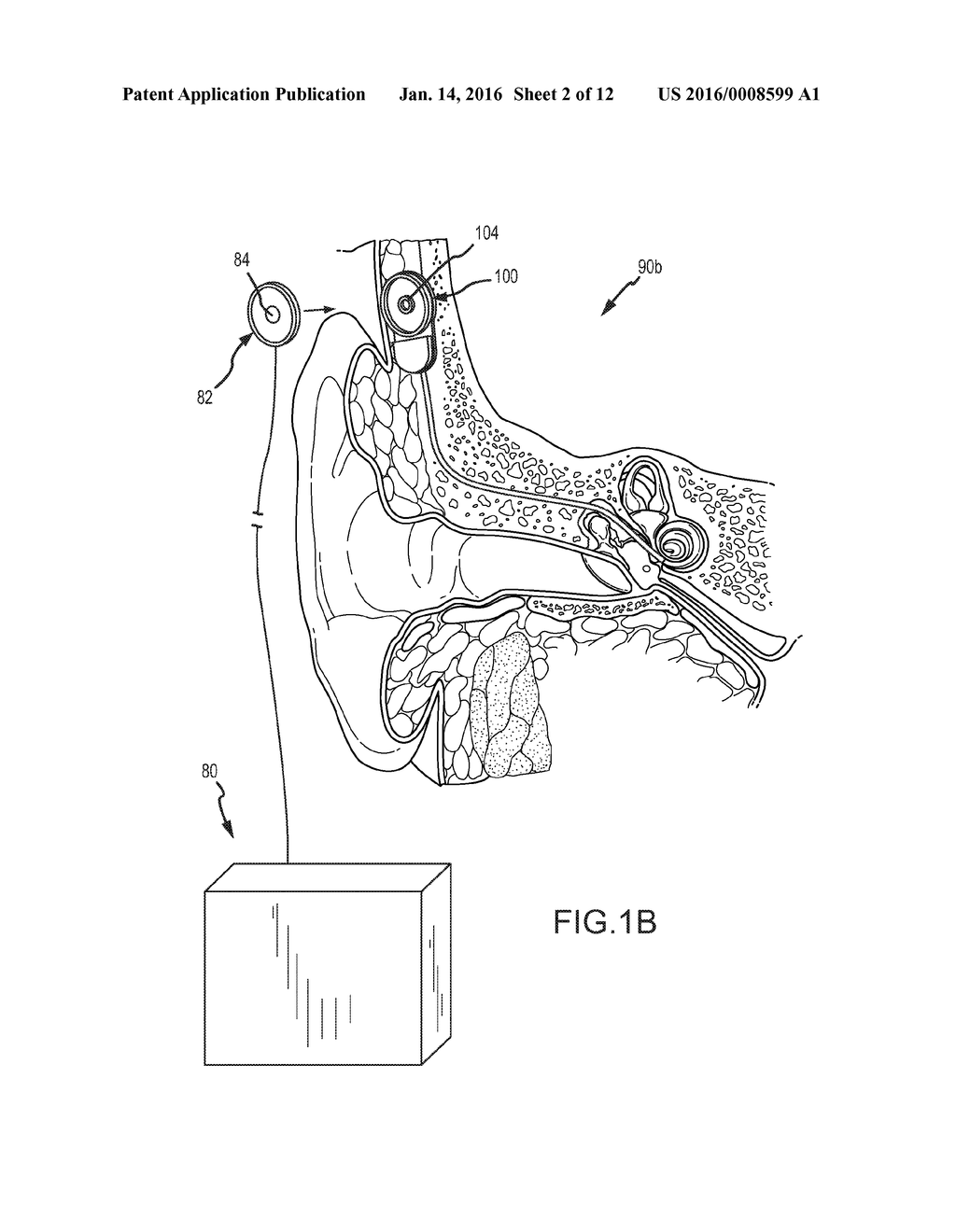 RELAY INTERFACE FOR CONNECTING AN IMPLANTED MEDICAL DEVICE TO AN EXTERNAL     ELECTRONICS DEVICE - diagram, schematic, and image 03