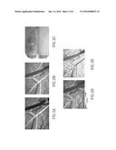 USE OF TRANSCRANIAL MAGNETIC STIMULATION TO MODULATE PERMEABILITY OF THE     BLOOD-BRAIN BARRIER diagram and image