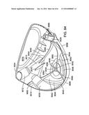 GOLF CLUB HEAD diagram and image