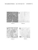 METHODS AND COMPOSITIONS RELATING TO PROLIFERATIVE DISORDERS OF THE     PROSTATE diagram and image