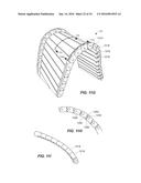 SUPPORT STRUCTURES FOR A FLEXIBLE ELECTRONIC COMPONENT diagram and image