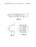 SUPPORT STRUCTURES FOR A FLEXIBLE ELECTRONIC COMPONENT diagram and image