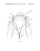 CLOTHING TOP FOR TECHNOLOGY CONCEALMENT diagram and image