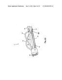 SUBSTANTIALLY RIGID AND STABLE ENDOLUMINAL SURGICAL SUITE FOR TREATING A     GASTROINTESTINAL LESION diagram and image