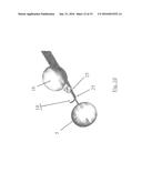 SUBSTANTIALLY RIGID AND STABLE ENDOLUMINAL SURGICAL SUITE FOR TREATING A     GASTROINTESTINAL LESION diagram and image