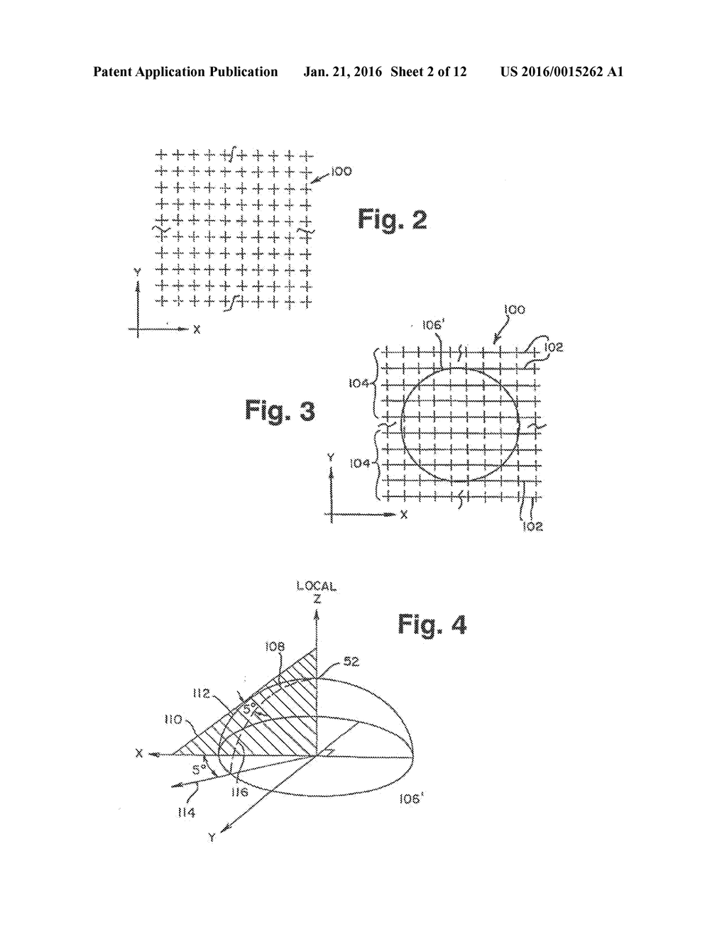 METHOD AND SYSTEM FOR IMPROVING VISION OF AN EYE WITH MACULAR DEGENERATION - diagram, schematic, and image 03