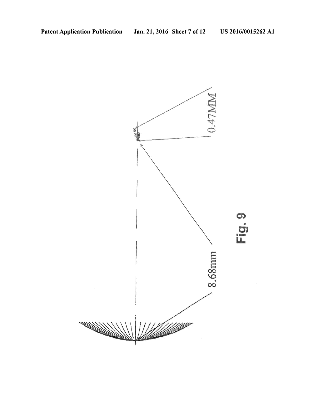 METHOD AND SYSTEM FOR IMPROVING VISION OF AN EYE WITH MACULAR DEGENERATION - diagram, schematic, and image 08