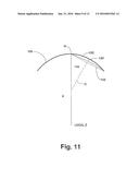 METHOD AND SYSTEM FOR IMPROVING VISION OF AN EYE WITH MACULAR DEGENERATION diagram and image