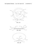 Medical Devices and Methods diagram and image