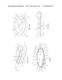 Medical Devices and Methods diagram and image