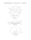 Medical Devices and Methods diagram and image