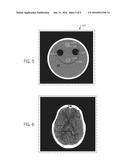 Brain Tissue Equivalent Material And Phantom Device Comprising The Same diagram and image