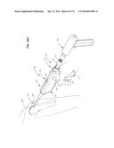 ARTHROSCOPIC SURGICAL DEVICE diagram and image