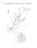 ARTHROSCOPIC SURGICAL DEVICE diagram and image