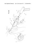 ARTHROSCOPIC SURGICAL DEVICE diagram and image