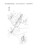 ARTHROSCOPIC SURGICAL DEVICE diagram and image