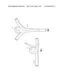 VASCULAR REMODELING DEVICE diagram and image