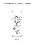 VASCULAR REMODELING DEVICE diagram and image