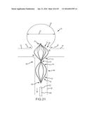 VASCULAR REMODELING DEVICE diagram and image