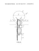 VASCULAR REMODELING DEVICE diagram and image