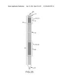 VASCULAR REMODELING DEVICE diagram and image