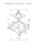 VASCULAR REMODELING DEVICE diagram and image